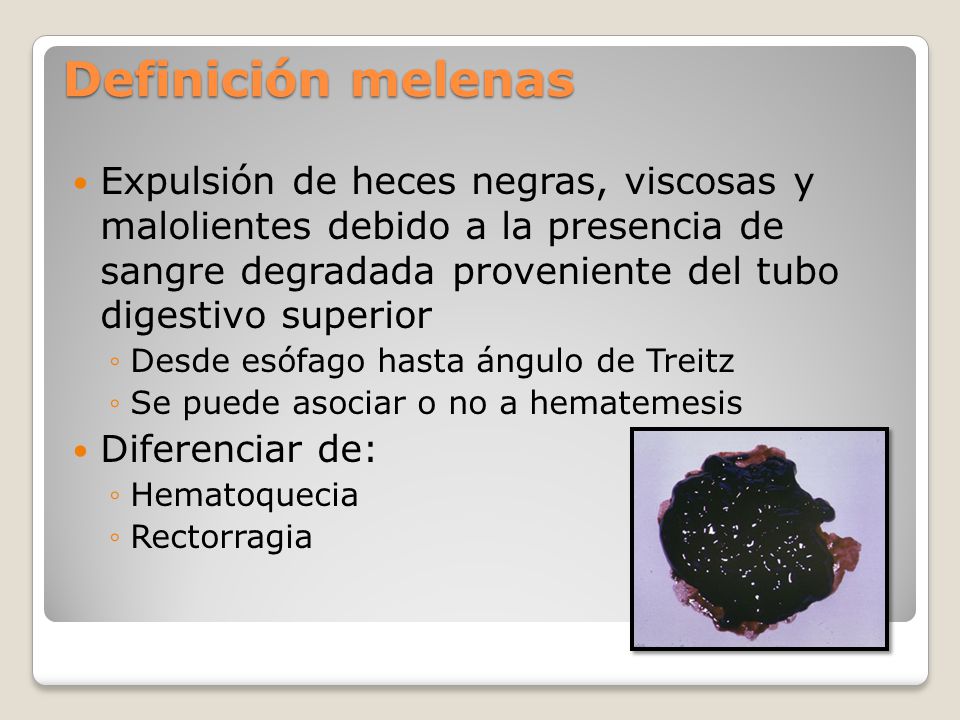 Melenas en las heces fotos
